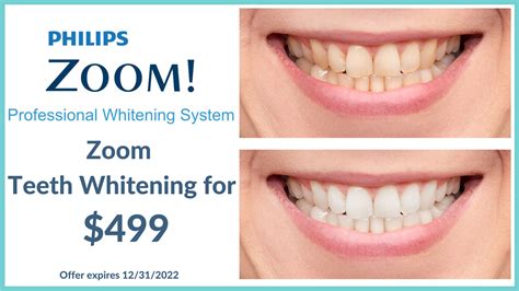 teeth whitening lodi|Philips Zoom! .